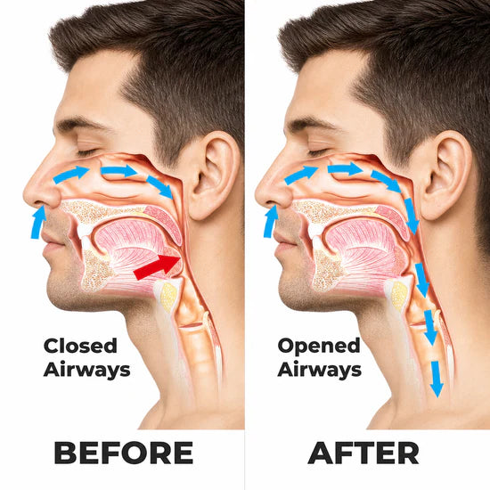 Somma Anti-Snoring Spray (Pack of 2)
