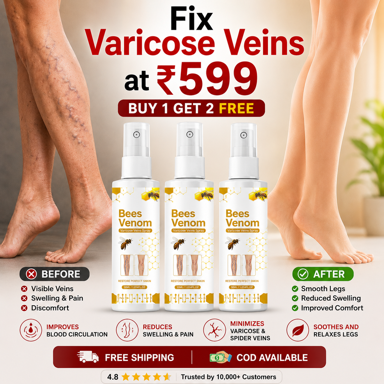 Venom Varicose Vein Relief Spray (BUY 1 GET 2 FREE 🎁)