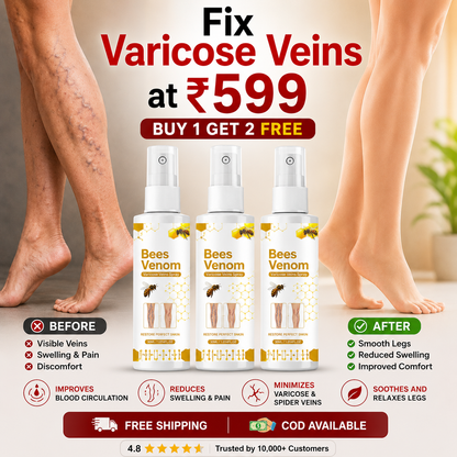 Venom Varicose Vein Relief Spray (BUY 1 GET 2 FREE 🎁)