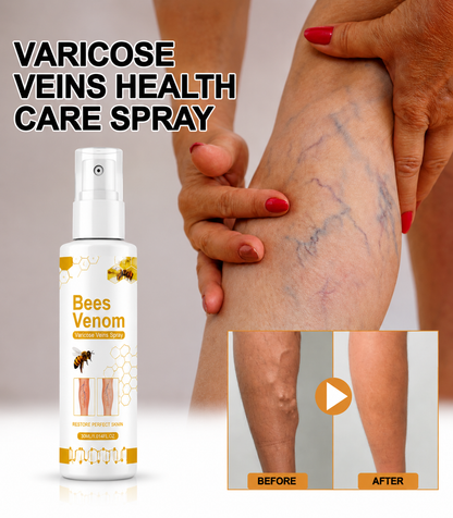 Venom Varicose Vein Relief Spray (BUY 1 GET 2 FREE 🎁)