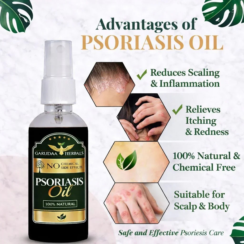 Garuda Herbal Psoriasis -Clearing Oil