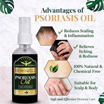 Garuda Herbal Psoriasis -Clearing Oil